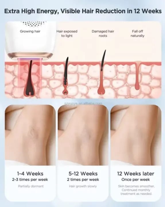 SE7 Salon High Intensity Hair Remover Device
